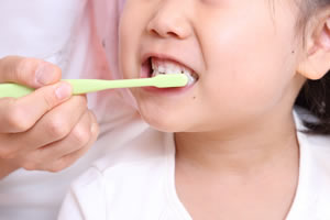 乳歯は虫歯になりやすいので予防が必要！
